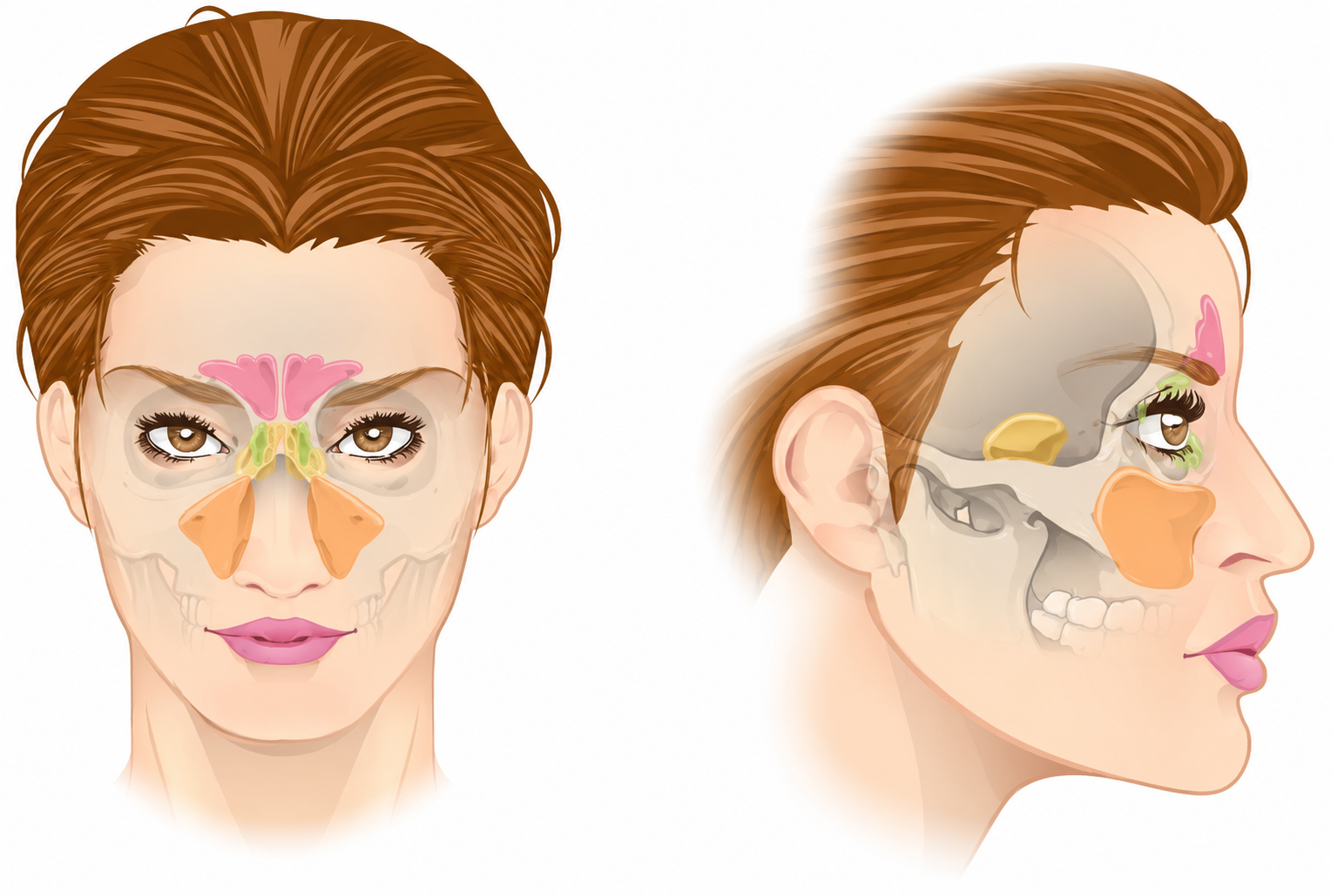 Anterior and lateral anatomy of the paranasal sinuses